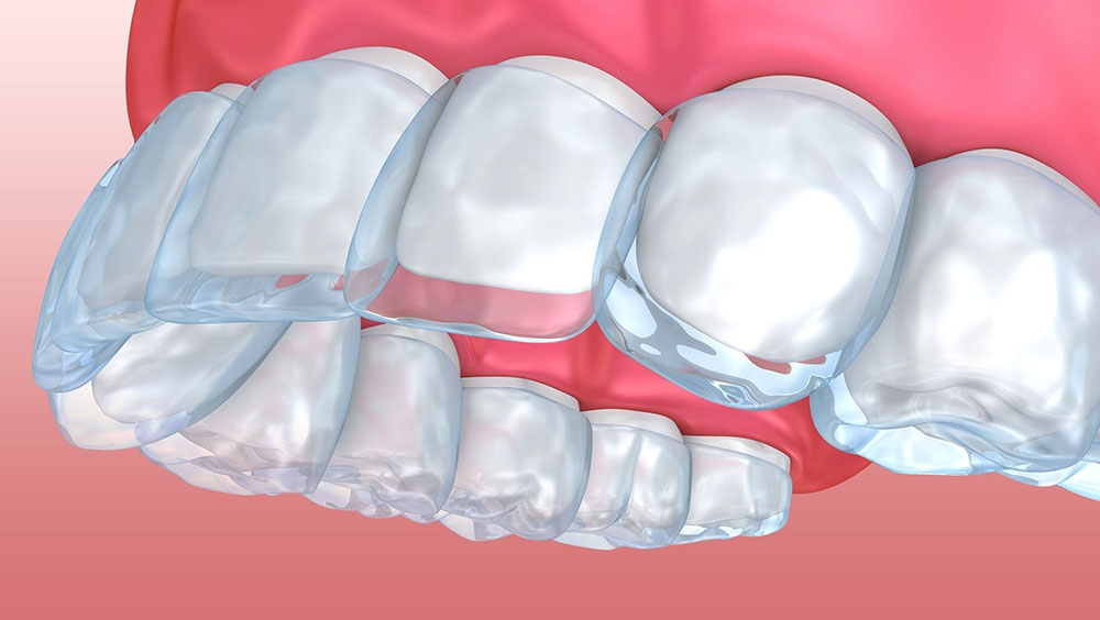 3d image of teeth