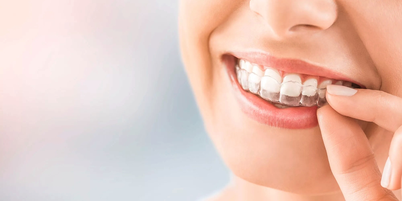 Orthodontist Linden, NJ - Magic Smile Dental